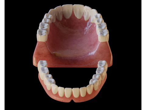 Human Teeth Prosthesis 3D Model