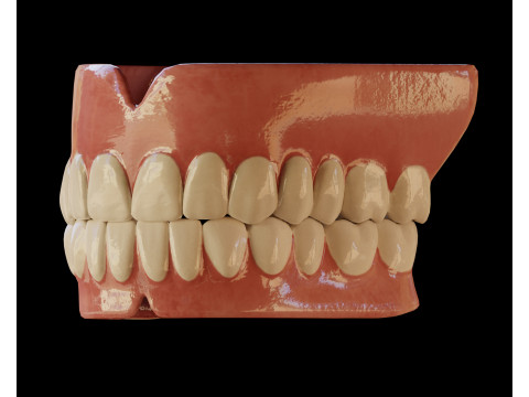 Human Teeth Prosthesis Modèle 3D
