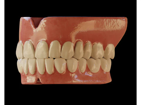Human Teeth Prosthesis 3D Model