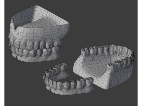 Human Teeth Prosthesis Modèle 3D