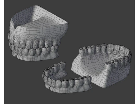 Human Teeth Prosthesis 3D Model