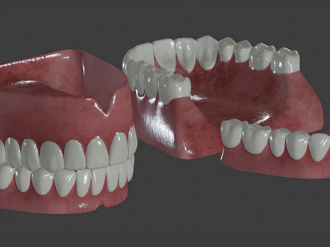 Human Teeth Prosthesis 3D Model