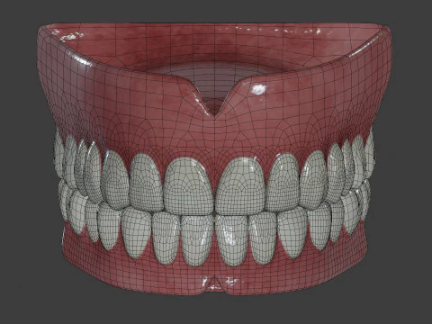 Human Teeth Prosthesis 3D Model