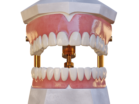 Dental Prosthesis 3D Model