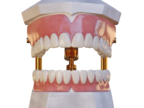 Dental Prosthesis 3D Model