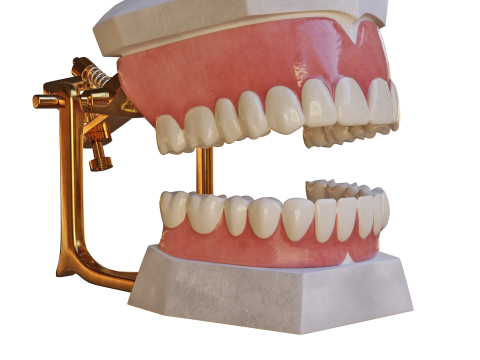 Dental Prosthesis 3D Model