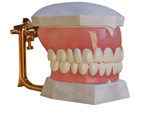 Dental Prosthesis 3D Model