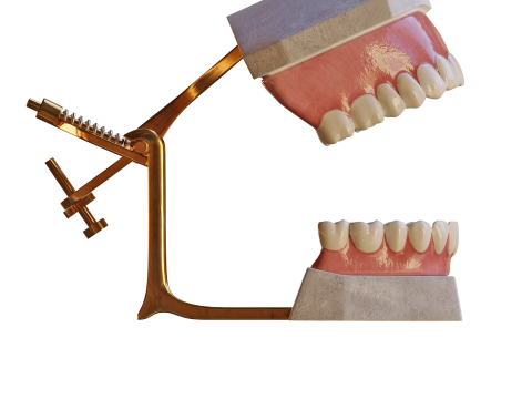 Dental Prosthesis 3D Model