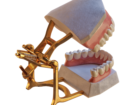 Dental Prosthesis 3D Model
