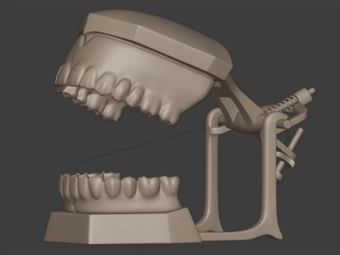 Dental Prosthesis 3D Model