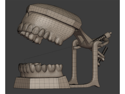 Dental Prosthesis 3D Model