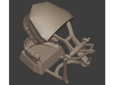 Dental Prosthesis 3D Model