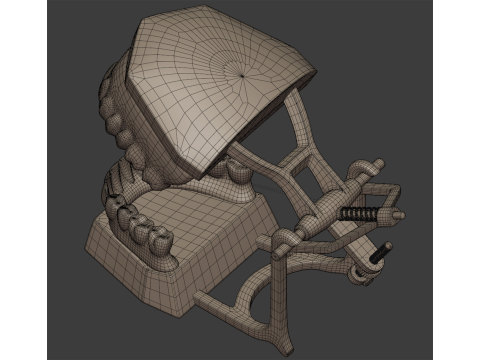 Dental Prosthesis 3D Model