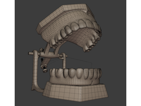 Dental Prosthesis 3D Model