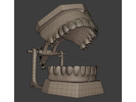 Dental Prosthesis 3D Model