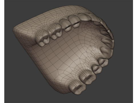 Dental Prosthesis 3D Model