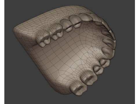 Dental Prosthesis 3D Model