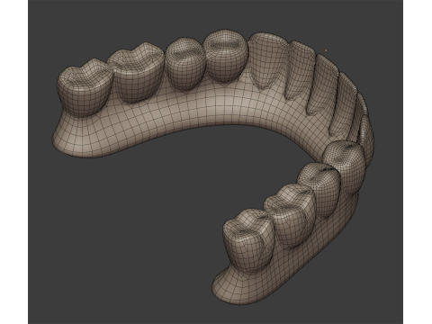 Dental Prosthesis 3D Model