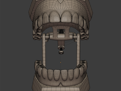 Dental Prosthesis 3D Model