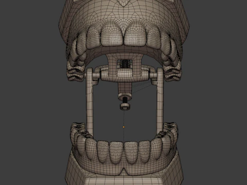 Dental Prosthesis 3D Model
