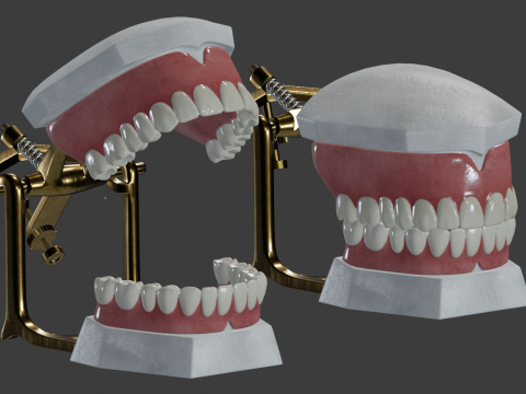 Dental Prosthesis 3D Model