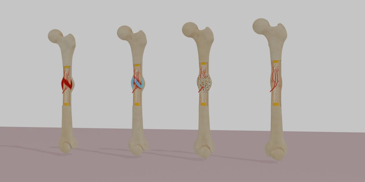 Human Long Bone Structure Internal Anatomy and Healing stages 3D Model .c4d .max .obj .3ds .fbx .stl .blend 