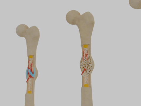 Human Long Bone Structure Internal Anatomy and Healing stages 3D Model