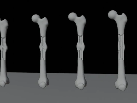 Human Long Bone Structure Internal Anatomy and Healing stages 3D Model