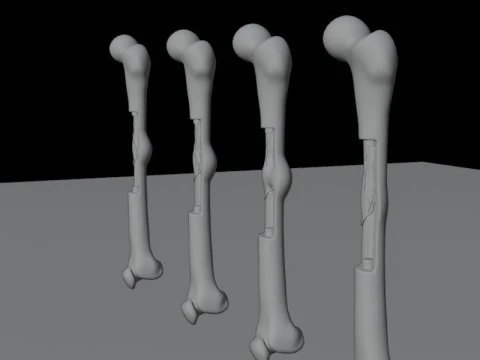 Human Long Bone Structure Internal Anatomy and Healing stages 3D Model