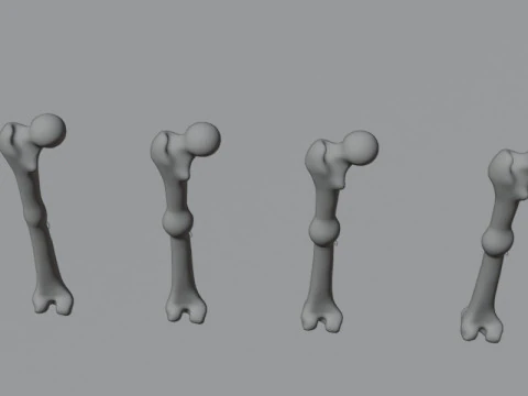 Human Long Bone Structure Internal Anatomy and Healing stages 3D Model