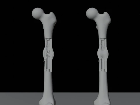 Human Long Bone Structure Internal Anatomy and Healing stages 3D Model