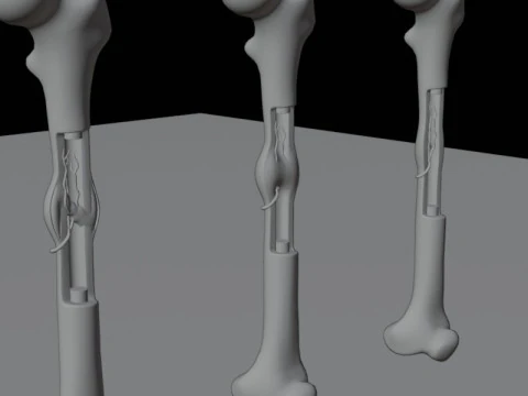 Human Long Bone Structure Internal Anatomy and Healing stages 3D Model