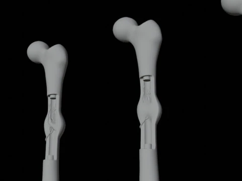 Human Long Bone Structure Internal Anatomy and Healing stages 3D Model