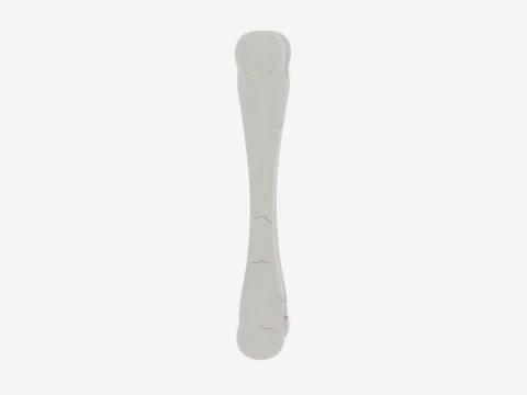 Realistic 3D Anatomy Model of Skeleton Leg Bone with Detailed Joints Marrow Exposure and Crack Patte 3D Model