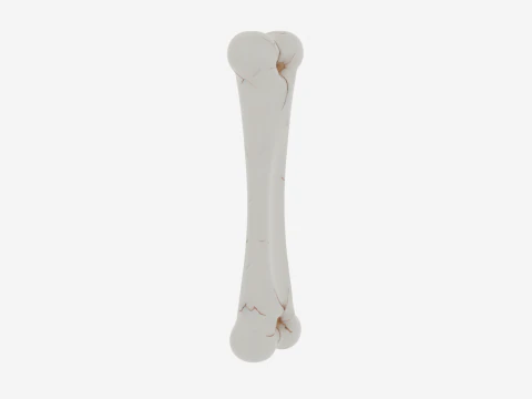 Realistic 3D Anatomy Model of Skeleton Leg Bone with Detailed Joints Marrow Exposure and Crack Patte 3D Model