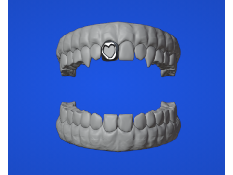 歯列弓 3Dモデル