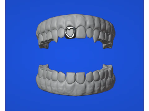 Dental arch 3D Model