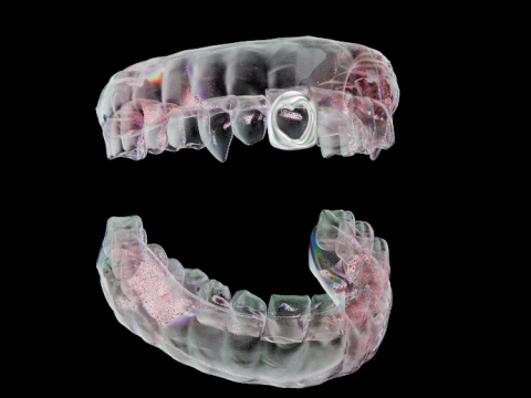 歯列弓 3Dモデル
