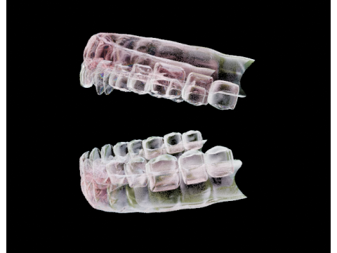 歯列弓 3Dモデル