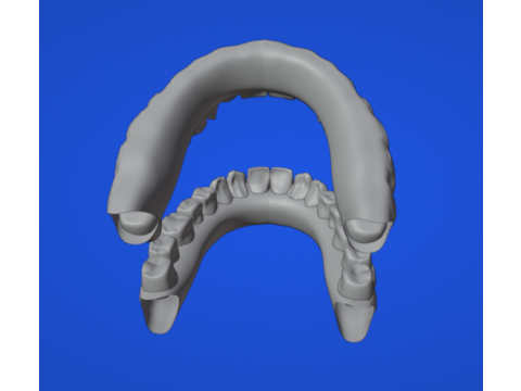 歯列弓 3Dモデル