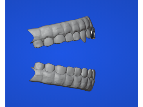 歯列弓 3Dモデル