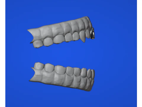 Dental arch 3D Model