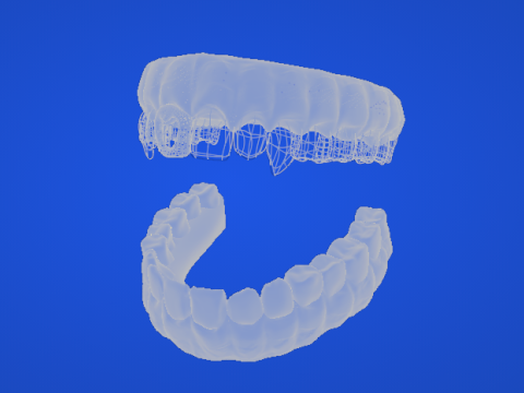 歯列弓 3Dモデル