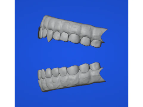Dental arch 3D Model