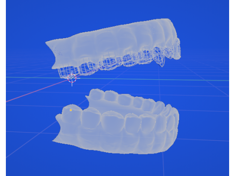 歯列弓 3Dモデル